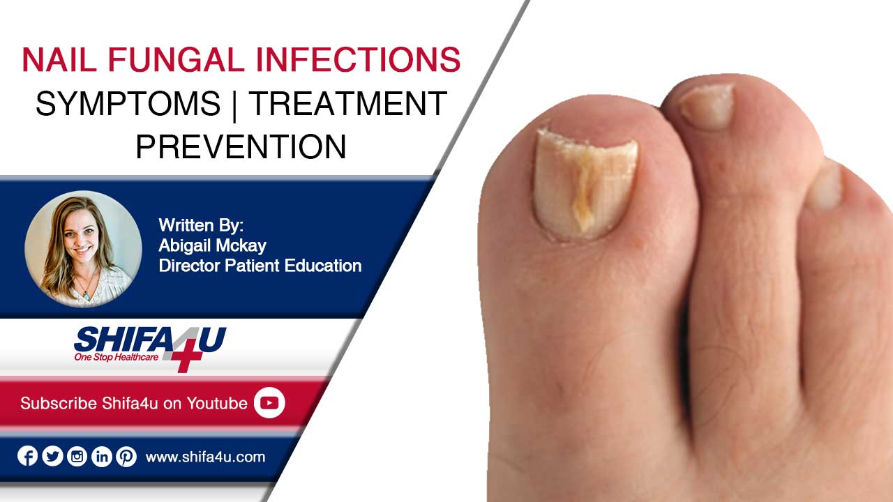 Nail Fungal Infections Symptoms Treatment Prevention Nail Fungal Infections Symptoms Treatment Prevention