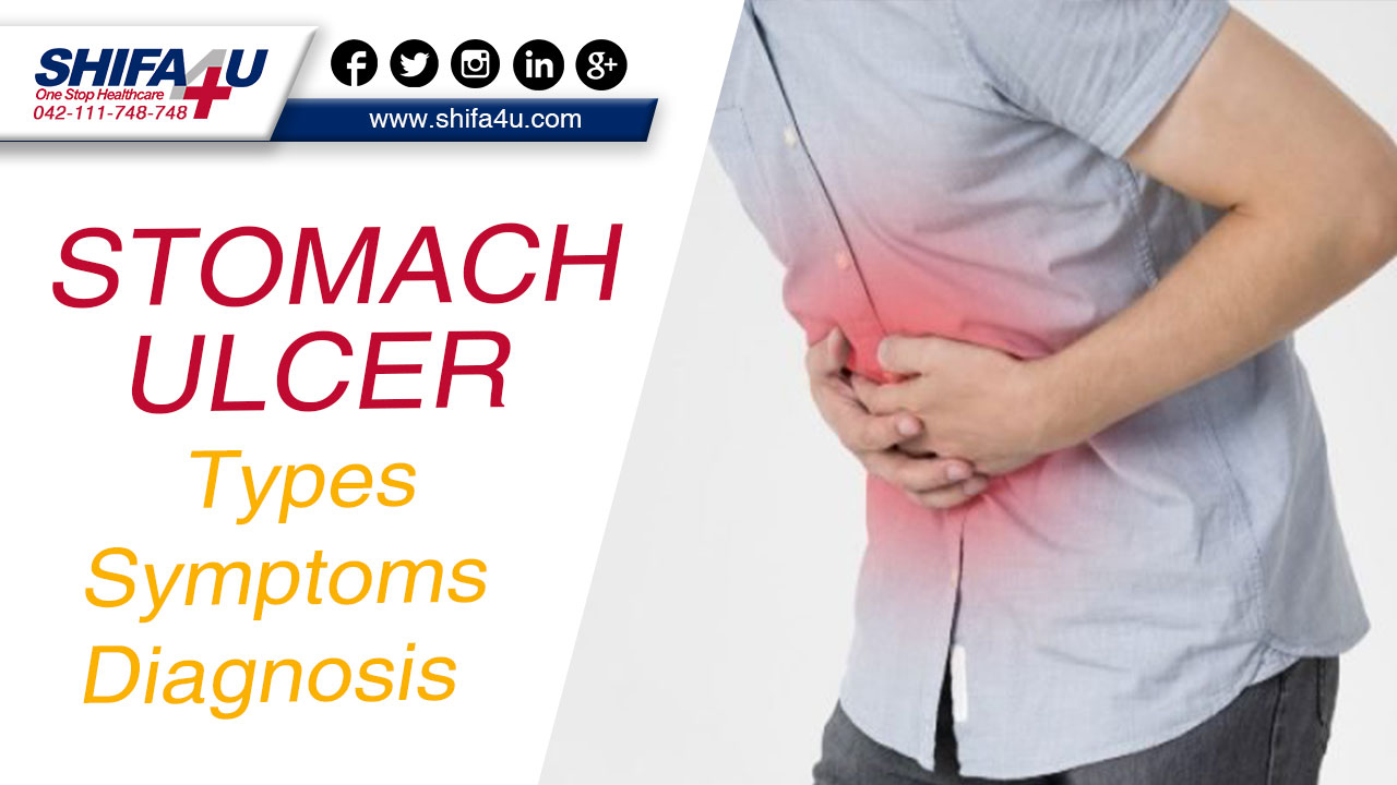 Stomach Ulcer: Types | Symptoms | Diagnosis
