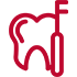 Root Canal Treatment (RCT)